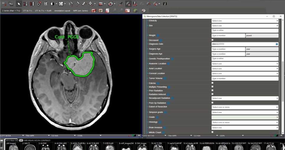 FHIR Webform SIIM23