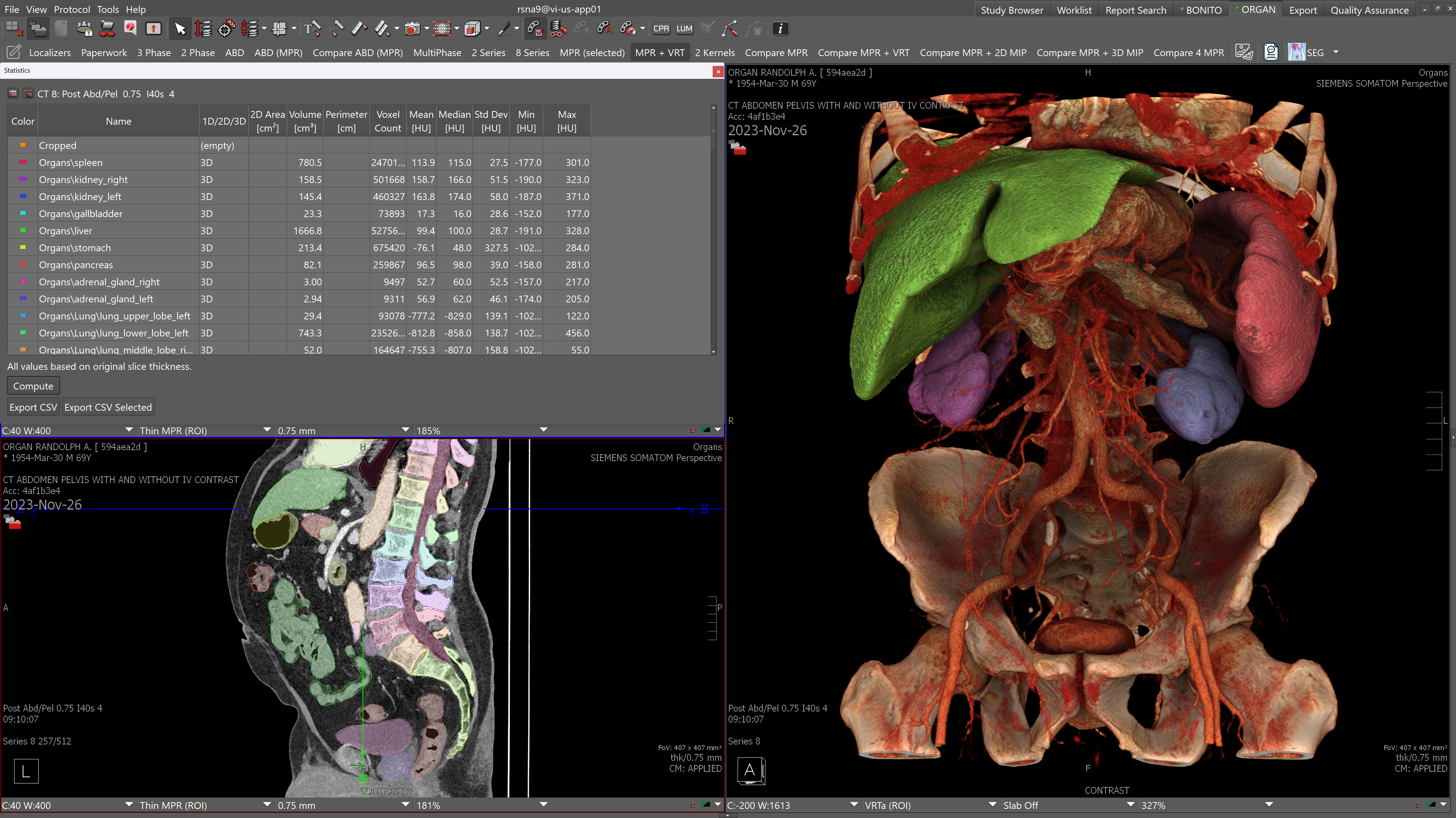 Organ Segmentation