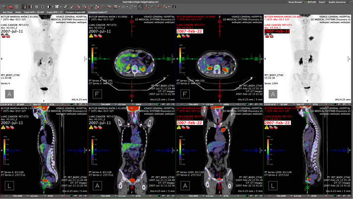 PETCT-1.jpg