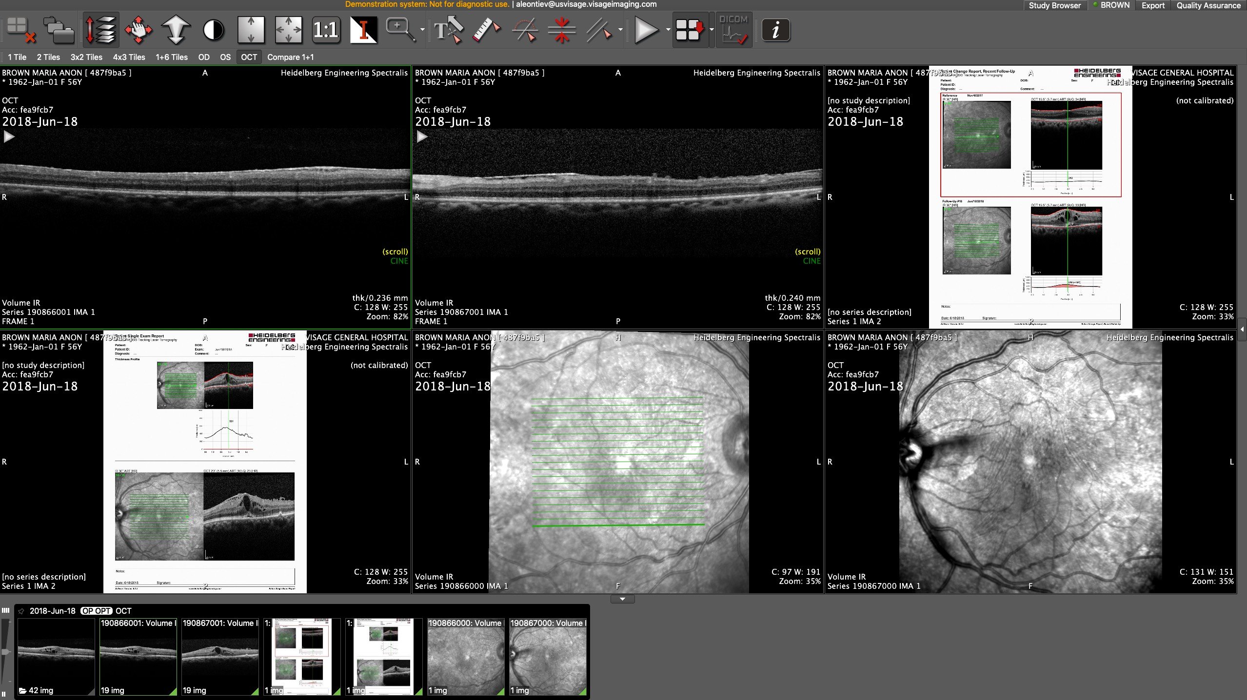 Visage 7 Ophthalmology