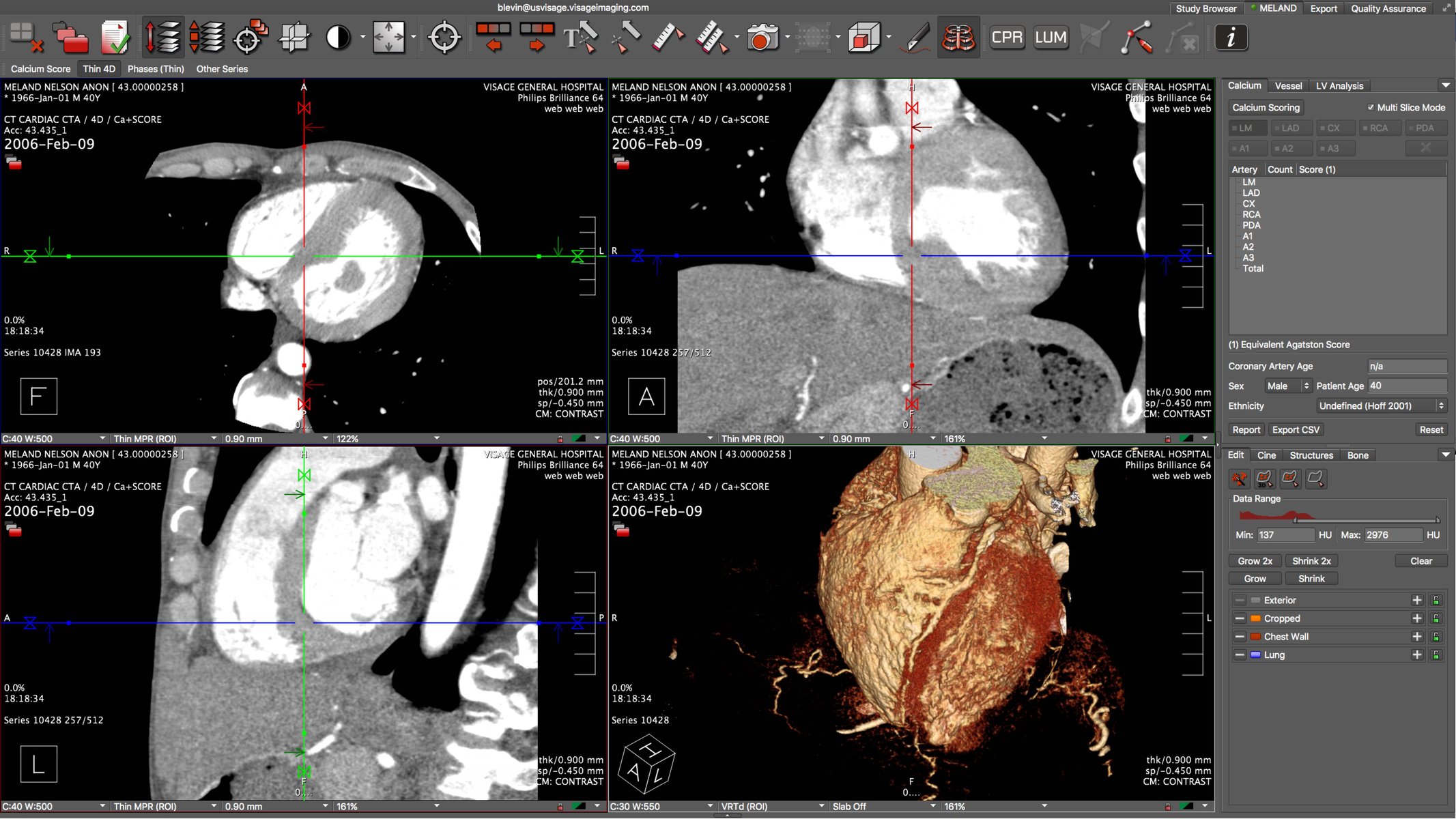 Can you? Visage can. Vol. 1 Speed Chapter 7 ThinSlice Reading