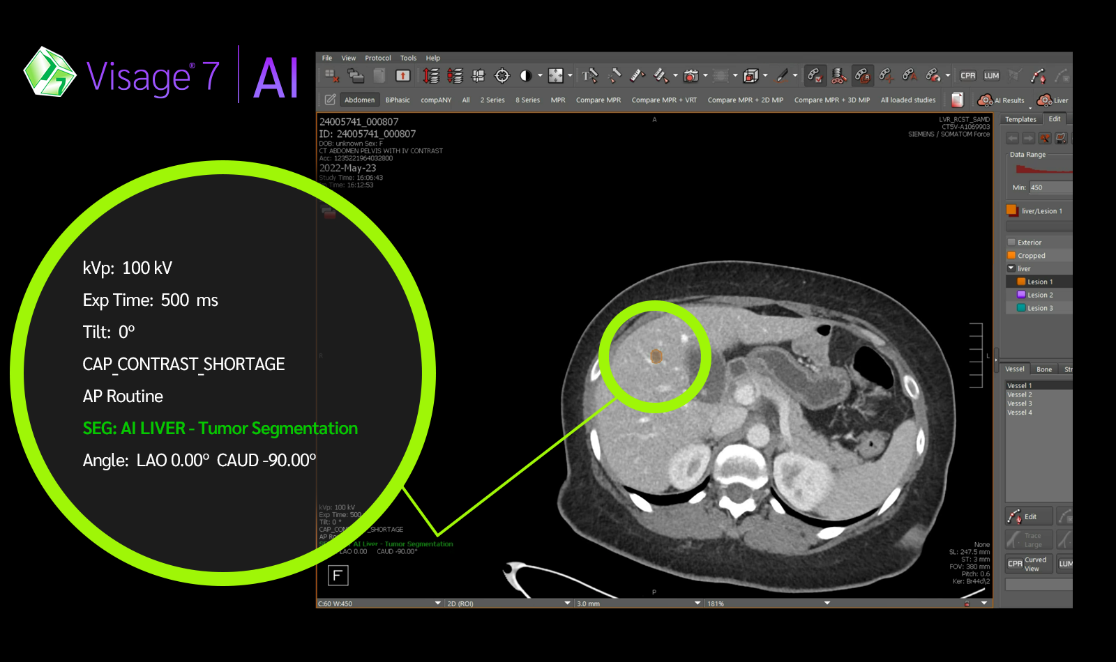 AI Results | Visage Leading the Way in Transparency