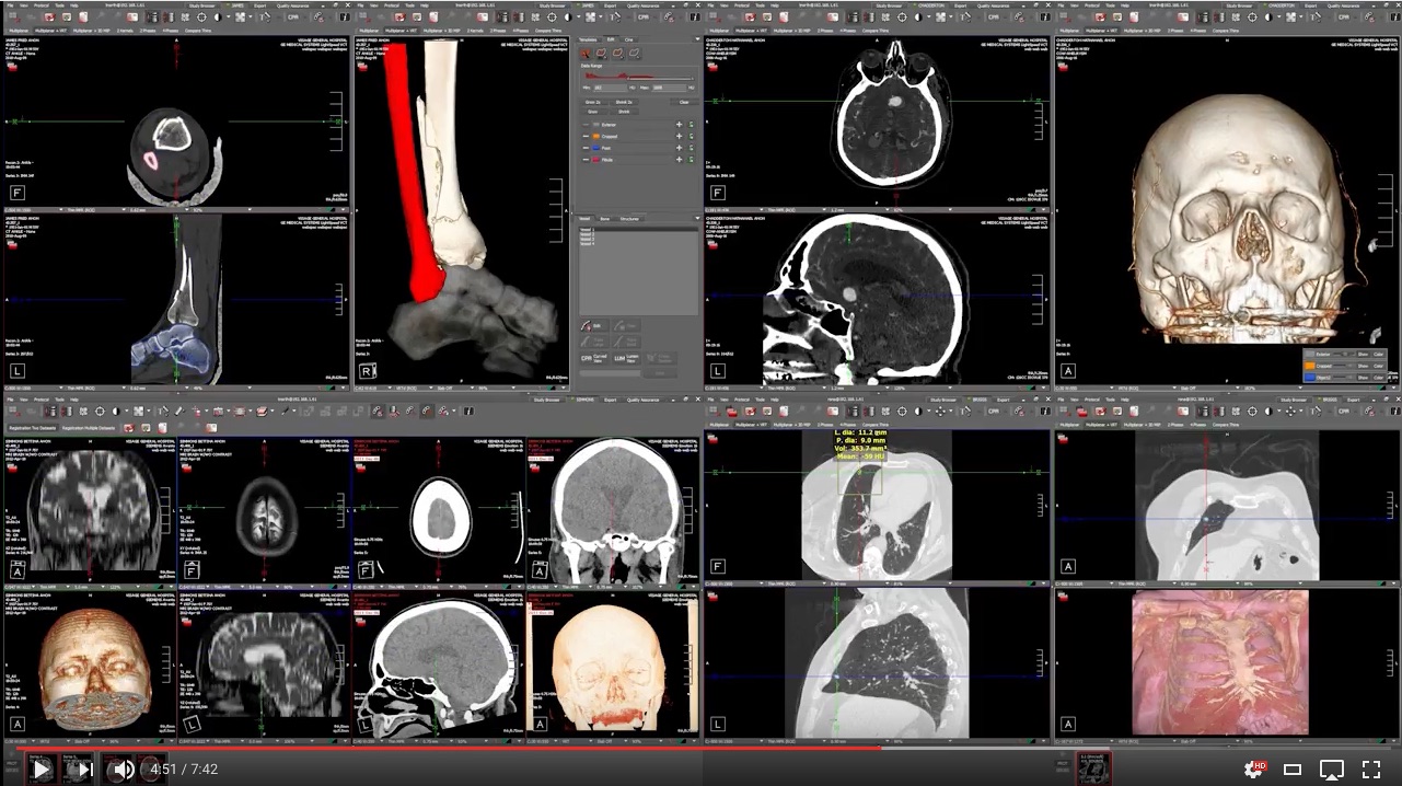 Breakthrough Clinical Depth with Visage