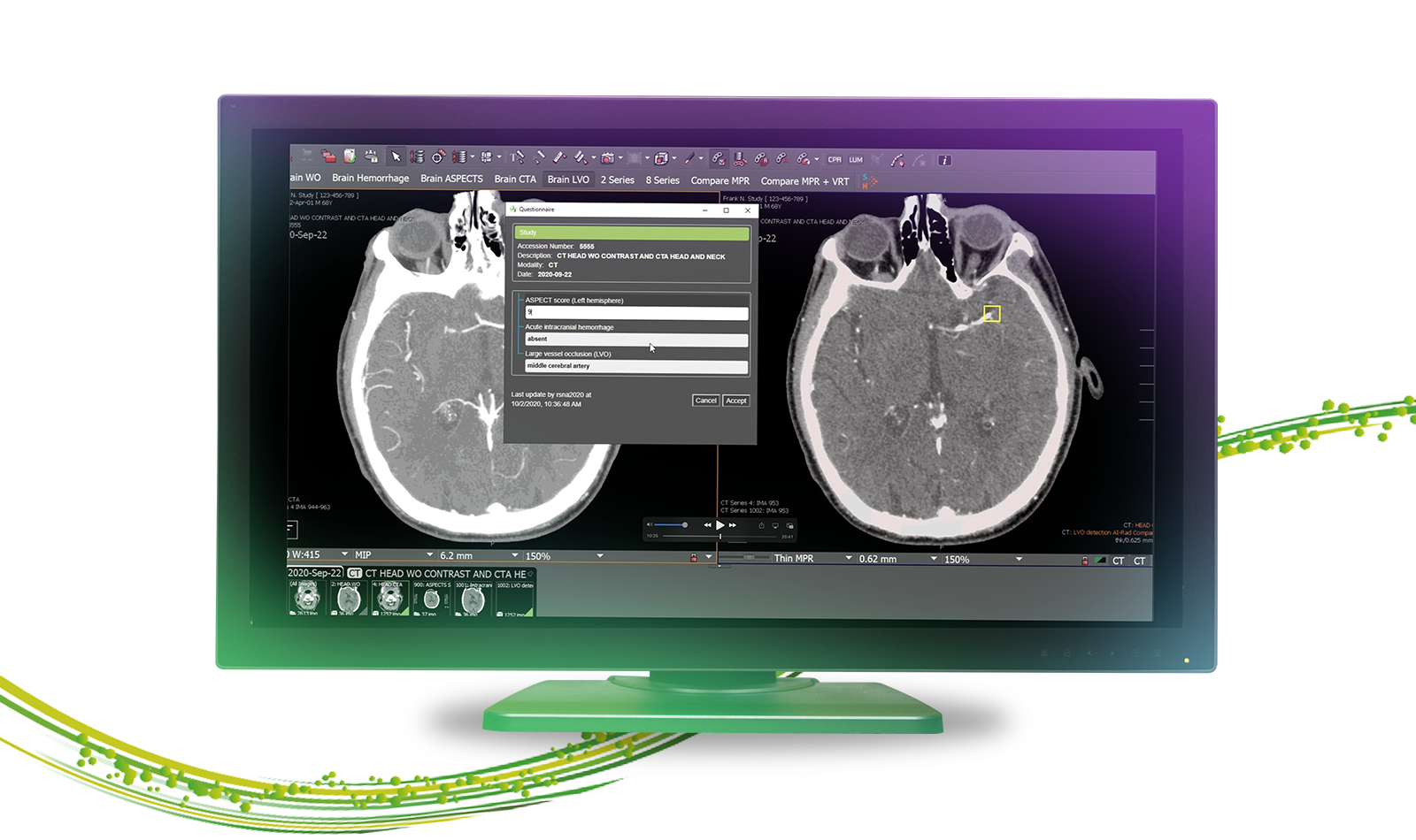 Imaging AI in Practice | Is It Real Yet?